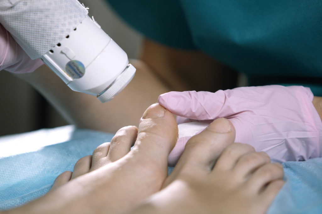 onychomycosis infection causes symptoms treatments possible preventions