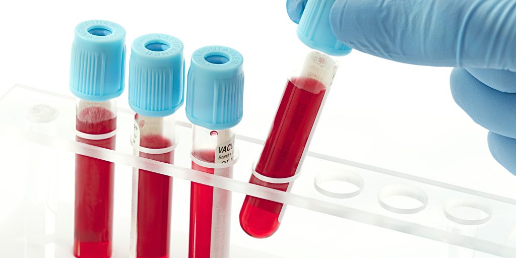 scientific discovery new revolutionary blood test detects cancer pinpoint location